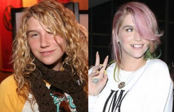 Kesha antes y después