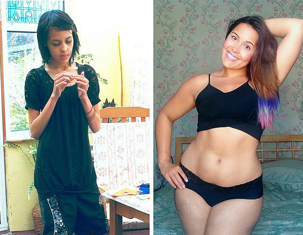 Orgullosa de su cuerpo tras superar la anorexia