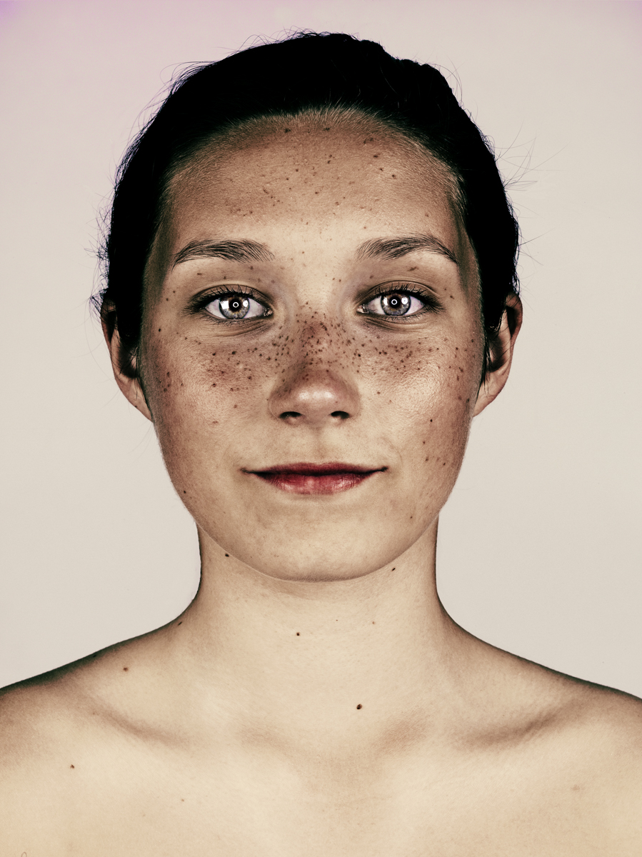 Brock Elbank, retratos de personas con pecas