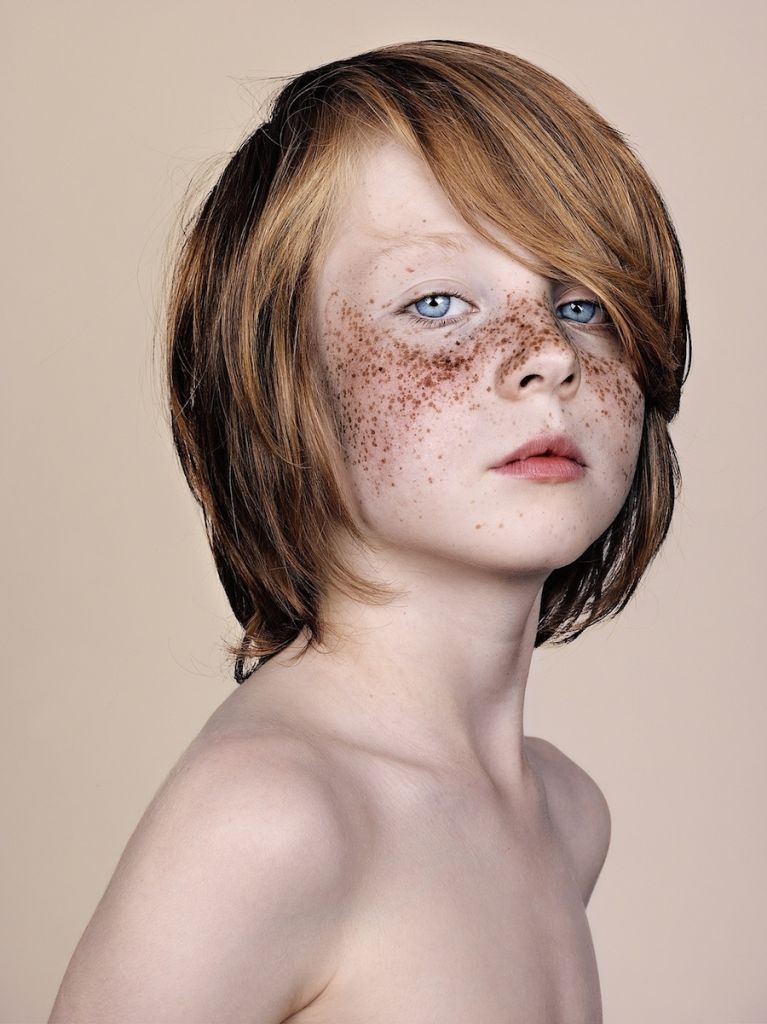 Brock Elbank, retratos de personas con pecas