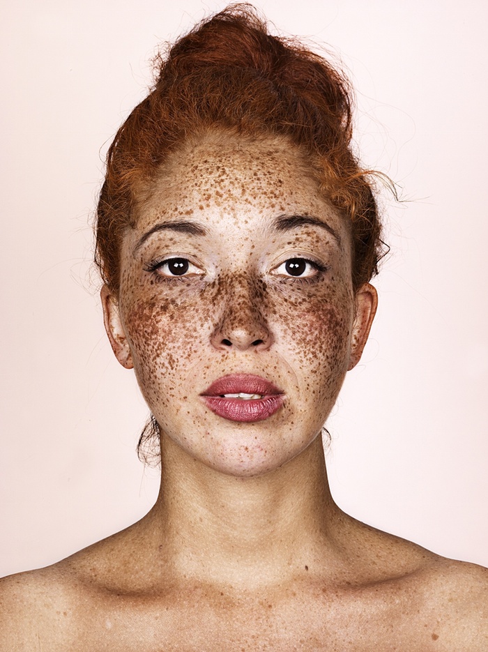 Brock Elbank, retratos de personas con pecas