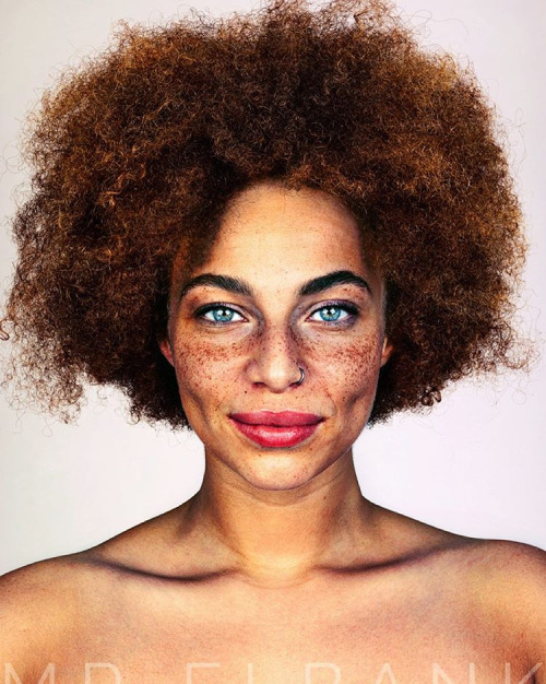 Brock Elbank, retratos de personas con pecas