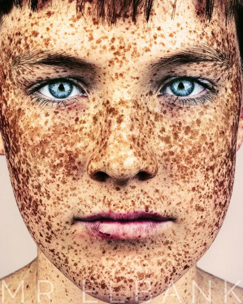 Brock Elbank, retratos de personas con pecas