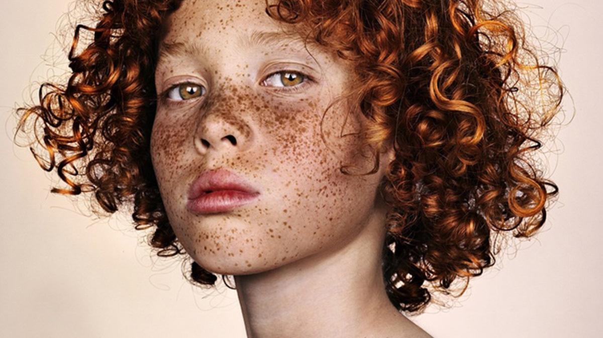 Brock Elbank, retratos de personas con pecas