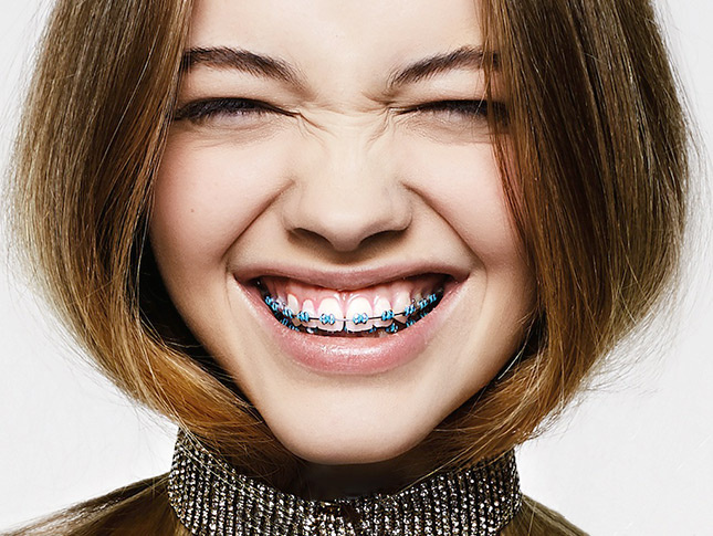 Chicas guapas con brackets