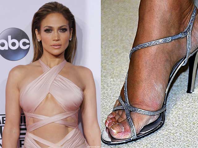 Las famosas con los pies más feos 