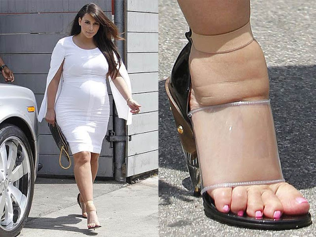 Las famosas con los pies más feos 