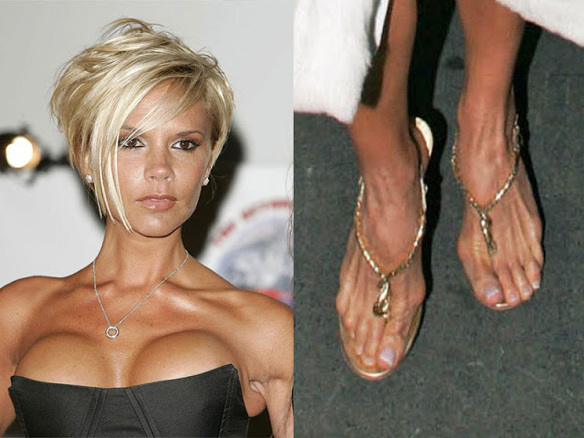 Las famosas con los pies más feos 