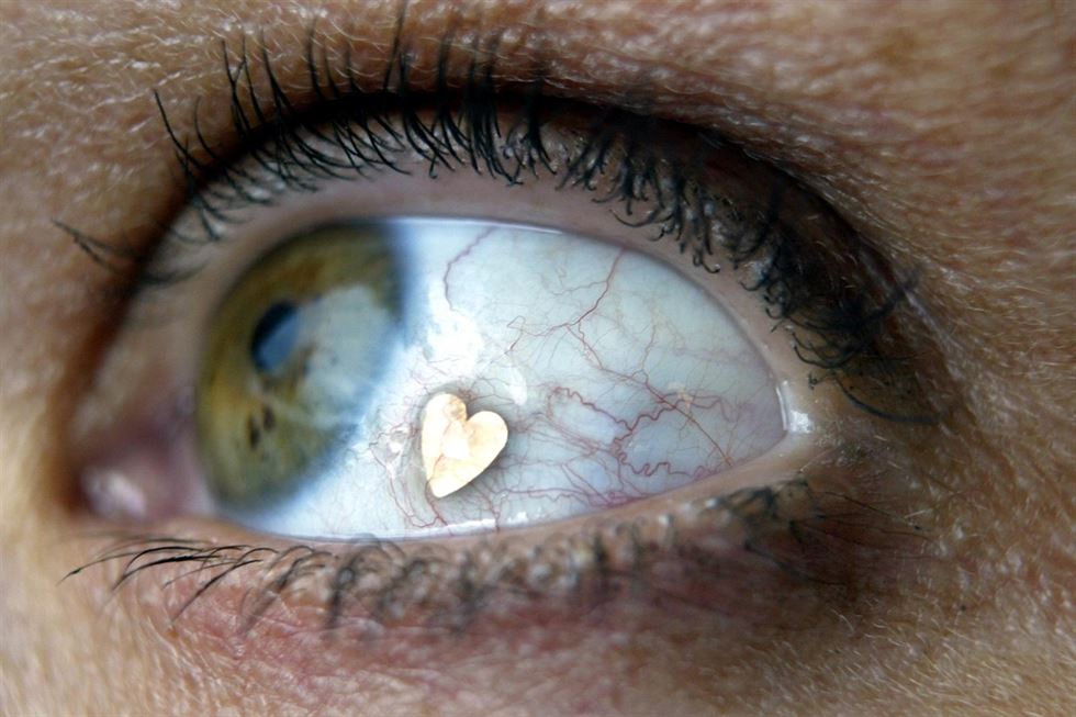 Implantes de joyas en los ojos