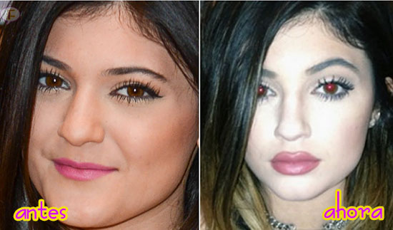 kylie Jenner antes y después