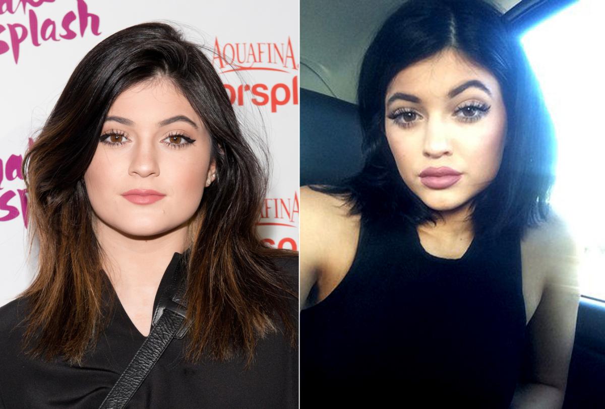 kylie Jenner antes y después