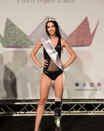 Chiara Bordi, aspirante a Miss Italia con prótesis