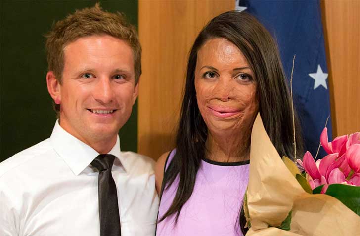 Turia Pitt y su marido 