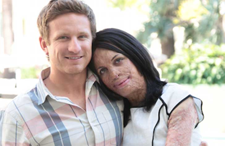 Turia Pitt y su marido 