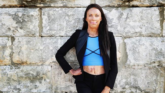 Turia Pitt y su marido 