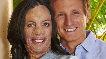 Turia Pitt y su marido 