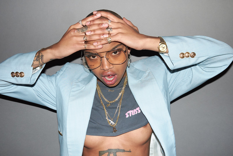 Slick Woods, la modelo imperfecta que quieren todas las firmas