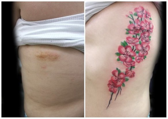 Esta tatuadora tapa cicatrices de mujeres maltratadas