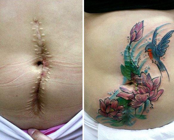 Esta tatuadora tapa cicatrices de mujeres maltratadas