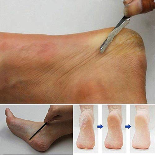 Cuchilla Profesional para Pies, zukabmw Pedicure Hard Skin Remover Cuidado de los pies Cuidado de callos Piel Muerta Rascador Pedicura Herramienta para la Piel de Cuerno Muerte, dura y agrietada piel