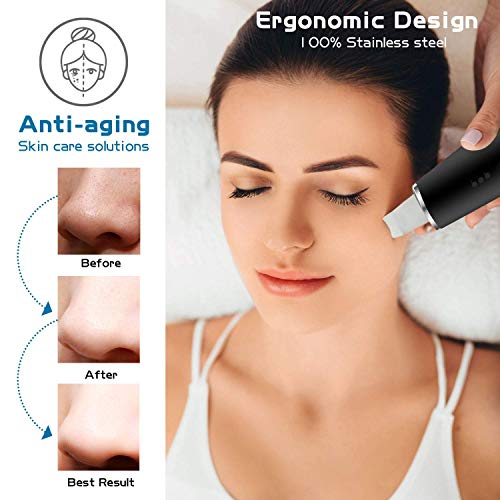 Espátula depuradora de Piel, Limpiador de poros con 3 Engranajes, espátula depuradora Facial, Extractor de Comedones para Limpieza Profunda Facial,Negro