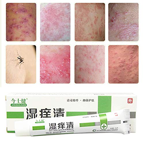 Tratamiento antiinflamatorio antipicazón para psoriasis, eccema, dermatitis, extracto de hierbas chinas, 20 g