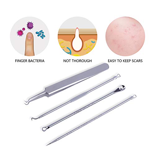 Beito Essentials Blackhead Remover Tool 4 Unids Profesional de Acné Inoxidable Spot Comedone Extractor Pinzas Kit de Eliminación de Espinilla