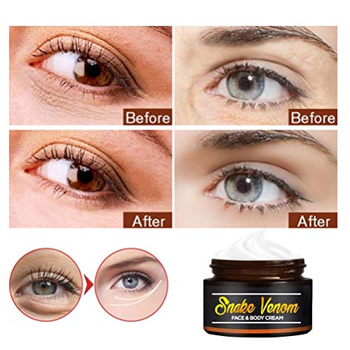 Crema Para Ojos De Veneno De Serpiente,Crema Antienvejecimiento Para Ojos De Veneno Serpiente,Cremas Tratamiento Múltiple Para Hidratar,Reducir Las Ojeras Hinchazón Las Bolsas Ojos Para Mujeres 30 Ml