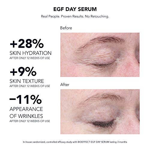 EGF Day Serum 30 ml