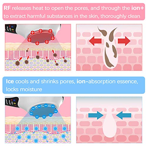 Máquina blanqueadora de la piel, dispositivo de tonificación facial antienvejecimiento de vibración RF caliente y frío, reductor de arrugas, elimina la limpieza de la piel edema y reduce los poros