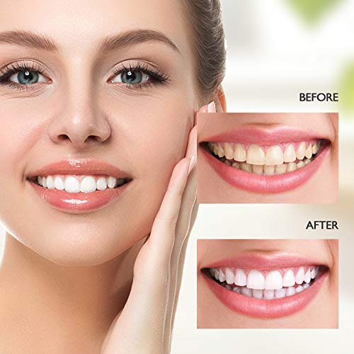 MitButy Lápiz Blanqueador Dental (3 Unidades) Gel Blanqueamiento Dental en Casa, Blanqueamiento de Dientes Profesional para una Bonita Sonrisa Blanca