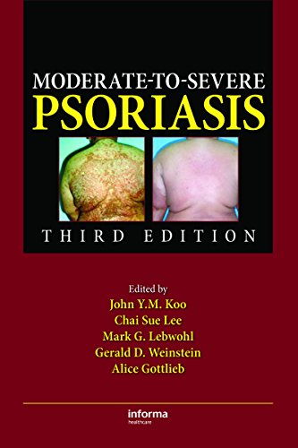 Moderate-to-Severe Psoriasis (English Edition)