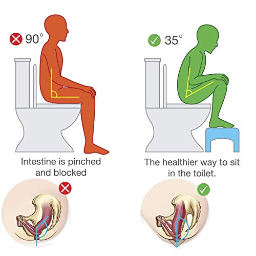 amzdeal Taburete para Inodoro, Taburete fisiológico de baño para niños y Adultos, Postura Saludable Recomendada por los médicos en el Inodoro | PP/Blanco (tamaño : 46x33x21)