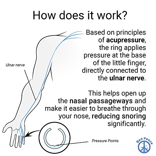 Anillo Antironquidos | La Solución Más Discreta para No Roncar | Acupresión | Eficacia Probada | Fácil y Cómodo de Usar | Dispositivo Antirronquidos | Manual Instrucciones Incluido | BedPeace