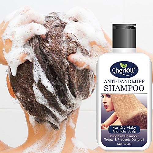 Anticaspa Champú, Anticaspa Champú para El Cabello Graso, Anticaspa Para Todos Los Tipos de Cabello,Champú r Anticaspa Para Todos Los Tipos de Cabello,2pc