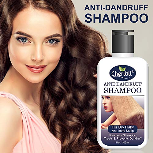 Anticaspa Champú, Anticaspa Champú para El Cabello Graso, Anticaspa Para Todos Los Tipos de Cabello,Champú r Anticaspa Para Todos Los Tipos de Cabello,2pc