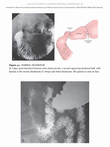 Atlas of Clinical Gastrointestinal Endoscopy: Expert Consult - Online and Print, 3e