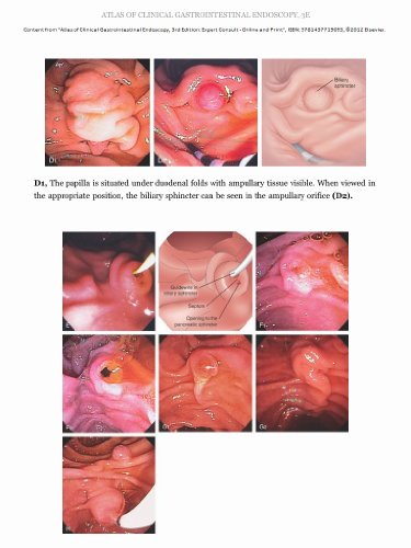 Atlas of Clinical Gastrointestinal Endoscopy: Expert Consult - Online and Print, 3e