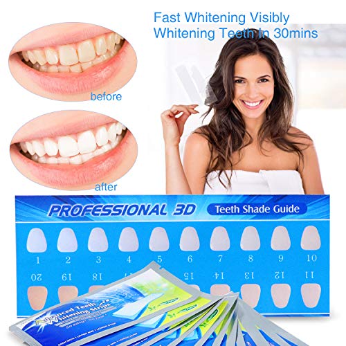 Blanqueador Dental, Nivlan 28PCS Blanqueador De Dientes Tiras Profesional, Sabor A Menta Tiras Blanqueadoras, Tiras De Blanqueamiento Dental, Antideslizante