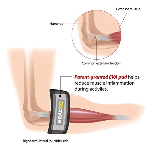 Bracoo EP40 I Cinta para Codo de Tenista y Golfista, Cinta con Almohadilla EVA, Ideal Epicondilitis Lateral, Medial y Tendinitis, 1 Cinta por Pack
