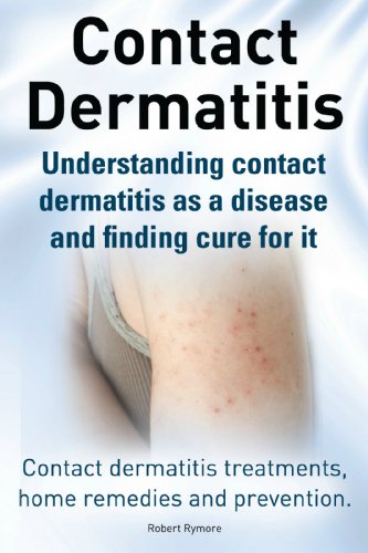 Contact Dermatitis. Contact dermatitis treatments, prevention and home remedies. Understanding contact dermatitis as a disease and finding cure for it. (English Edition)