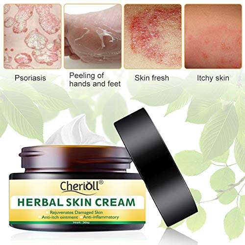 Crema para el cuerpo, tratamiento para la psoriasis, eccema, rosácea y dermatitis, la crema herbal china natural reduce la sequedad y la inflamación