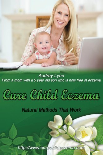 Cure Child Eczema: Natural Eczema Remedies That Work (English Edition)