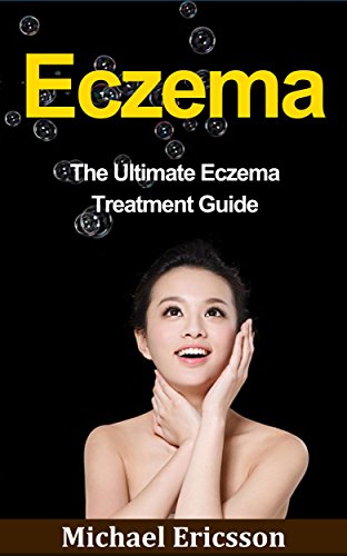 Eczema: The Ultimate Eczema Treatment Guide: How To Remove Eczema Permanently And Cure Eczema Forever Using 100% Guaranteed Natural Remedies (Eczema, Eczema ... Seborrheic Dermatitis) (English Edition)