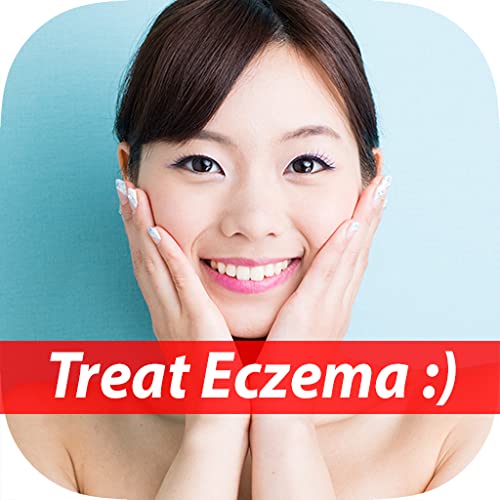 How To Treat Your Eczema - Best Way To Handle Your Eczema (Body, Face, Hand, Baby, etc.) For Beginners