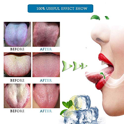 Limpiadores de lengua,3 Piezas Raspador limpiador de lengua acero inoxidable con Caja Anti-Microbiano combatir el mal aliento mantiene la higiene bucal Medicina Ayurveda Reutilizable Salud Oral