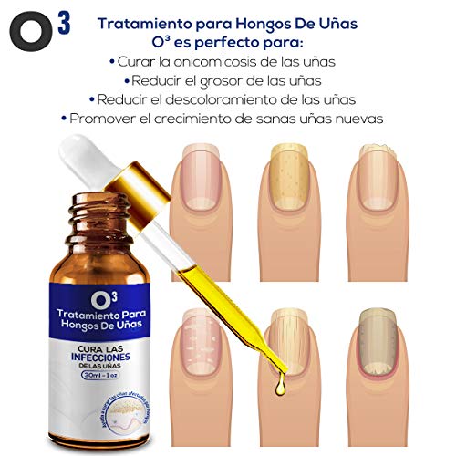 O³ Tratamiento Para Hongos Uñas Pies – Líquido Eliminar Hongos Uñas – Juego Antihongos Uñas Pies – Reduce Dureza De Las Uñas