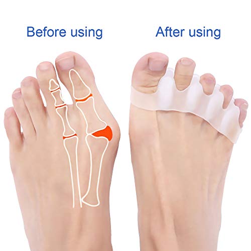 Separador dedos pie, Corrector De Juanetes para Noche y Día Set de 6 piezas, Protección de Juanetes y Hallux Valgus- 0% BPA - Talla universal