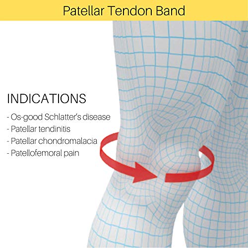 Correa de apoyo para el tendón rotuliano, alivio del dolor de rodilla con correa de silicona ajustable para hombres y mujeres, tendinitis, correr, senderismo, fútbol, voleibol, sentadillas