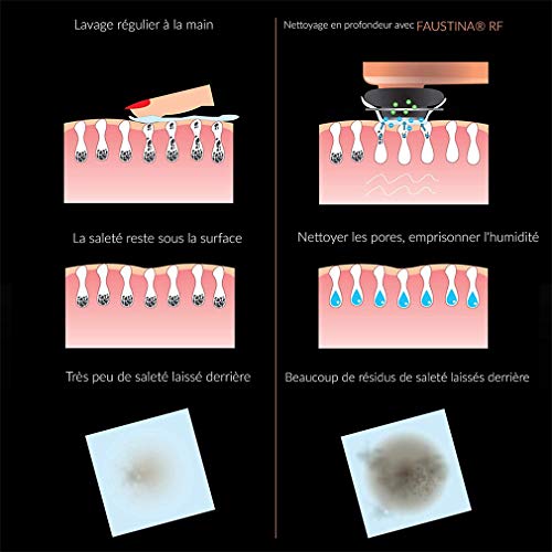 Dispositivo de belleza de radiofrecuencia para contraer poros, antiarrugas, mejora el cutis, el levantador de la piel y el limpiador de la piel